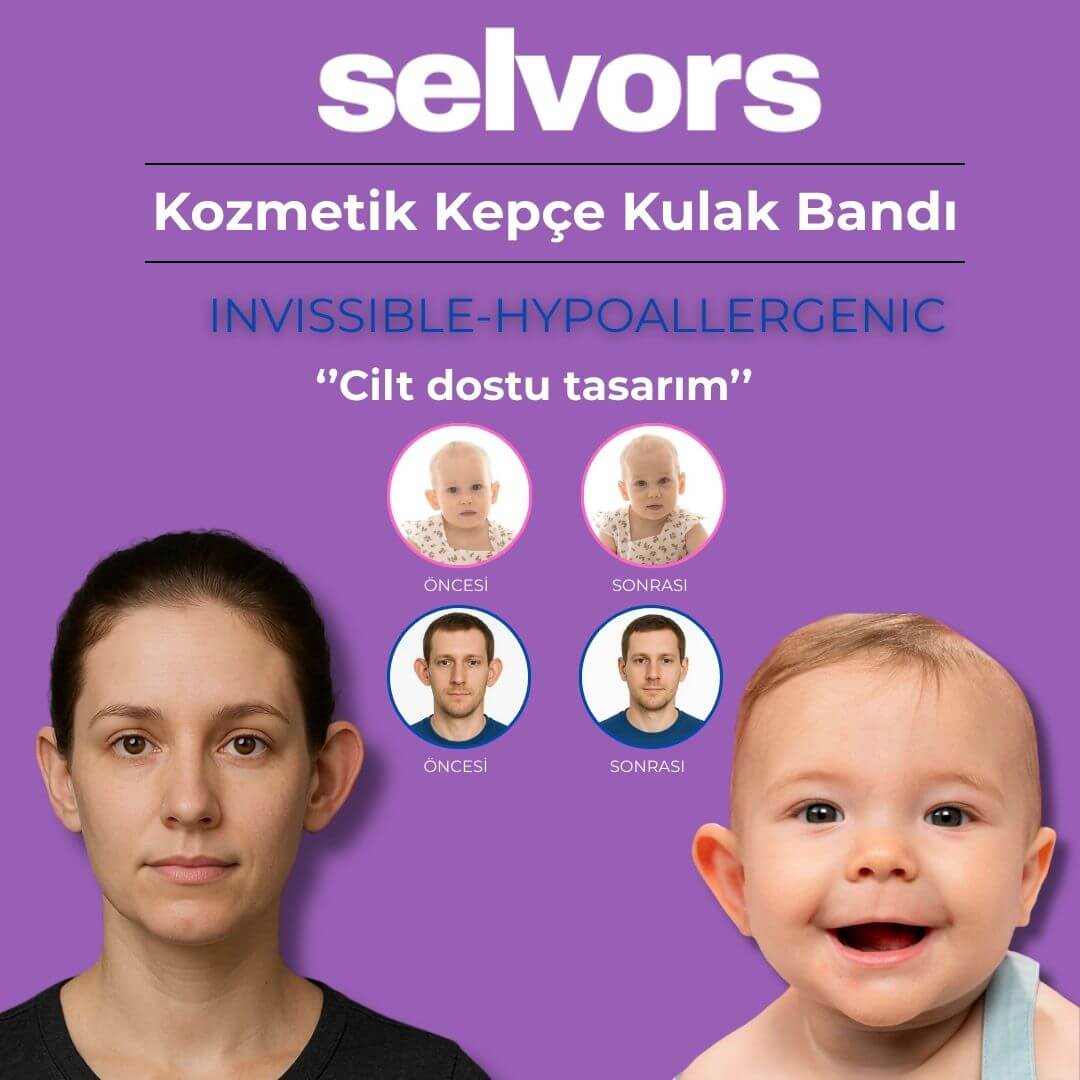Selvors® Kepçe Kulak Düzeltme Bandı